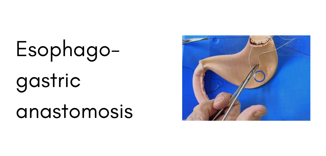 Surgery13
