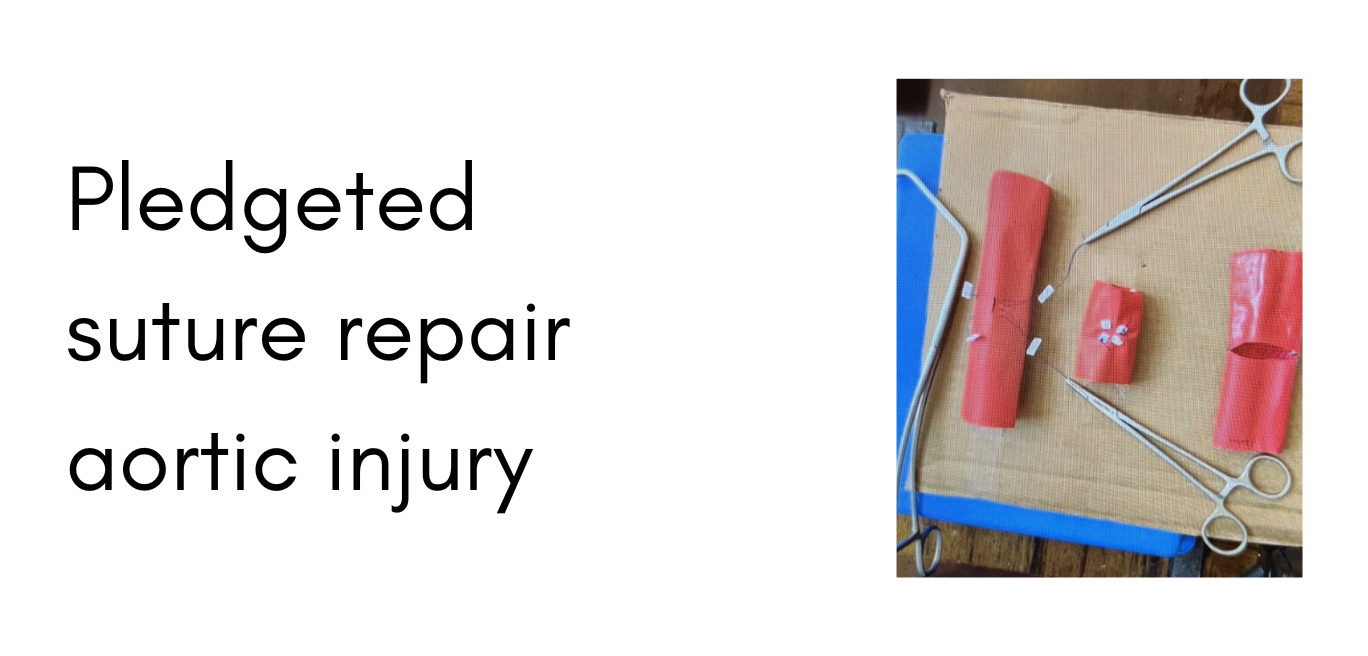 Surgery14