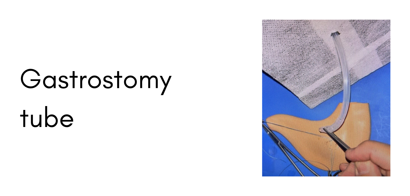 Surgery15