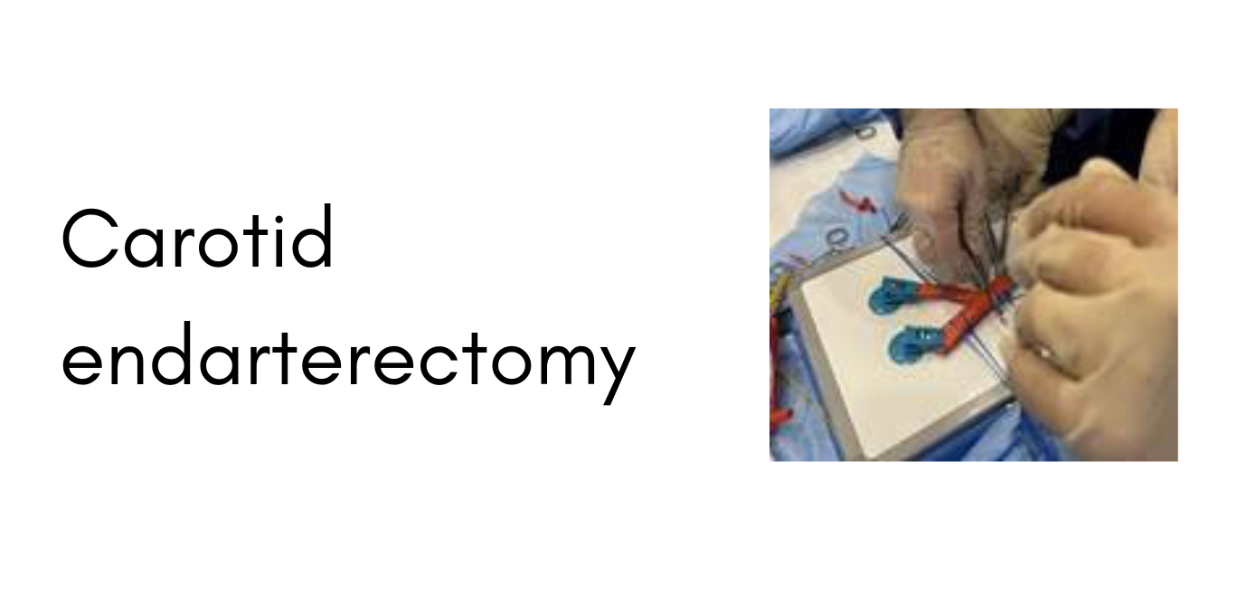 Surgery19