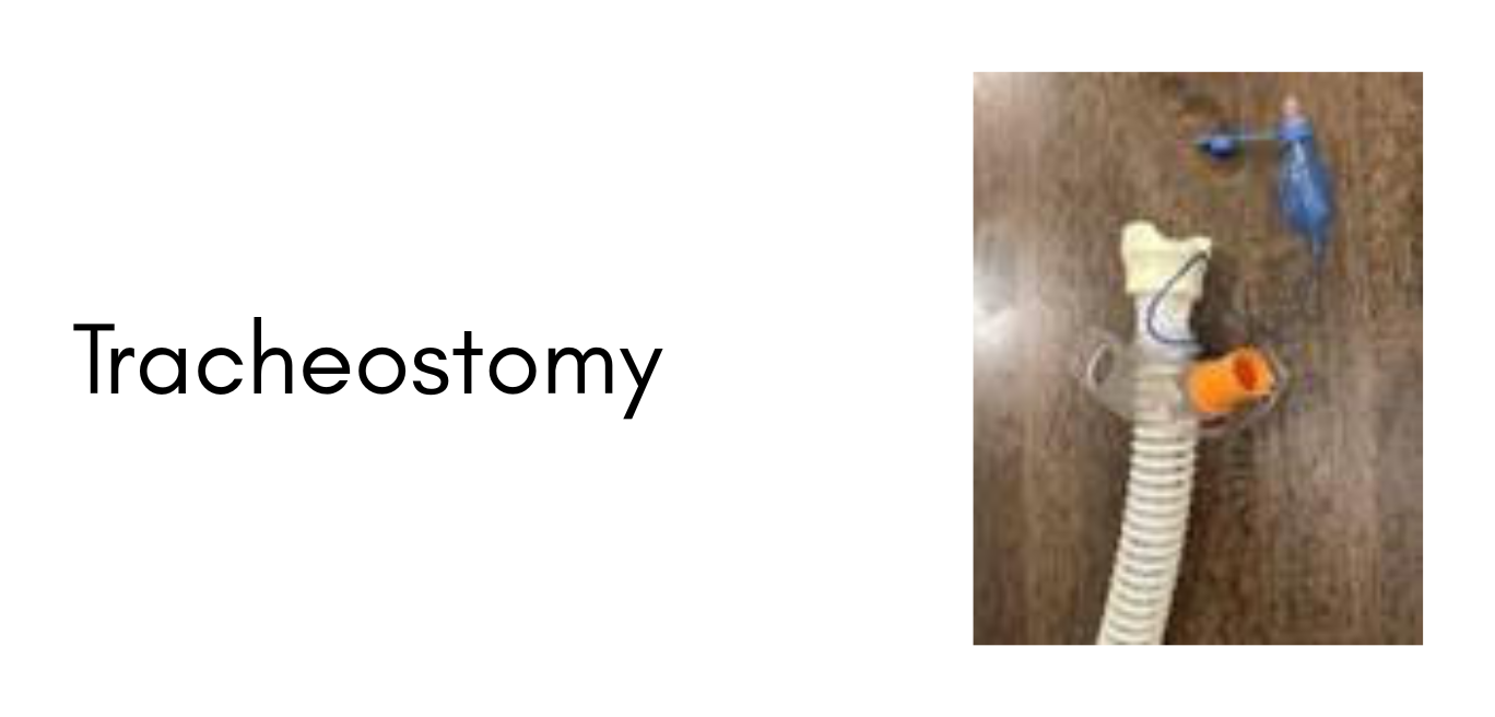Surgery21