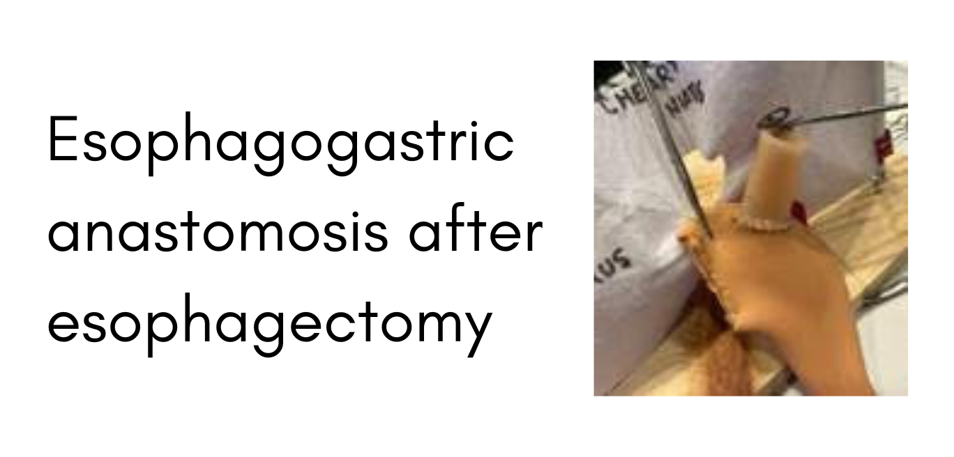 Surgery27